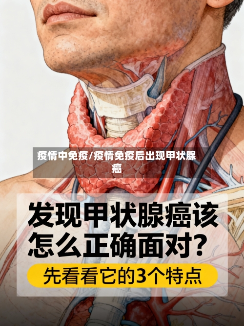 疫情中免疫/疫情免疫后出现甲状腺癌
